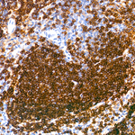 CD22 Recombinant Rabbit Monoclonal Antibody (0Z7Z10)