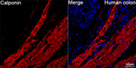 Calponin 1 Antibody in Immunohistochemistry (Paraffin) (IHC (P))