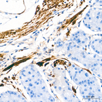 Calponin 1 Recombinant Rabbit Monoclonal Antibody (4S6O2)