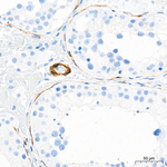 Calponin 1 Antibody in Immunohistochemistry (Paraffin) (IHC (P))
