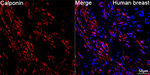 Calponin 1 Antibody in Immunohistochemistry (Paraffin) (IHC (P))