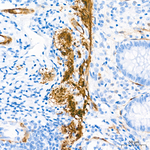 Calponin 1 Antibody in Immunohistochemistry (Paraffin) (IHC (P))