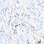 Calponin 1 Antibody in Immunohistochemistry (Paraffin) (IHC (P))