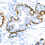 Calponin 1 Antibody in Immunohistochemistry (Paraffin) (IHC (P))