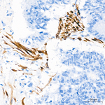 Calponin 1 Antibody in Immunohistochemistry (Paraffin) (IHC (P))