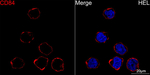 CD84 Recombinant Rabbit Monoclonal Antibody (5Z9R7)