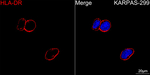 HLA-DR Recombinant Rabbit Monoclonal Antibody (7M4L1)