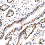 KPNA6 Recombinant Rabbit Monoclonal Antibody (1L4L10)