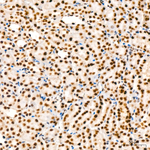 KPNA6 Antibody in Immunohistochemistry (Paraffin) (IHC (P))