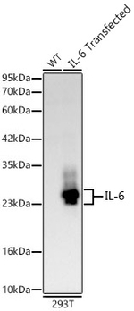 IL-6 Antibody in Western Blot (WB)