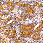MVP Recombinant Rabbit Monoclonal Antibody (1P3D9)