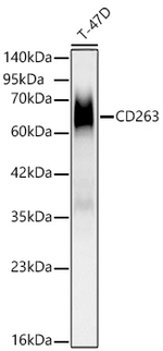CD263 (TRAIL-R3) Recombinant Rabbit Monoclonal Antibody (1V8S1)