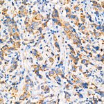 GPD2 Antibody in Immunohistochemistry (Paraffin) (IHC (P))
