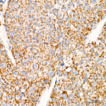 GPD2 Antibody in Immunohistochemistry (Paraffin) (IHC (P))