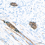 ALK Antibody in Immunohistochemistry (Paraffin) (IHC (P))