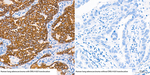 ALK Recombinant Rabbit Monoclonal Antibody (6F4N9)