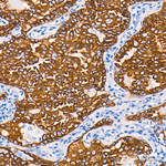 ALK Antibody in Immunohistochemistry (Paraffin) (IHC (P))