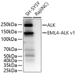 ALK Antibody in Western Blot (WB)