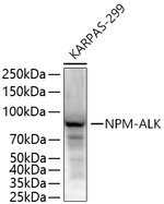 ALK Antibody in Western Blot (WB)
