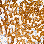 GLDC Antibody in Immunohistochemistry (Paraffin) (IHC (P))