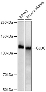 GLDC Antibody in Western Blot (WB)