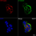 TFF1 Recombinant Rabbit Monoclonal Antibody (1L6U9)