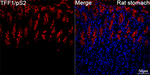 TFF1 Antibody in Immunohistochemistry (Paraffin) (IHC (P))