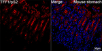 TFF1 Antibody in Immunohistochemistry (Paraffin) (IHC (P))