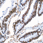 Lamin A/C Antibody in Immunohistochemistry (Paraffin) (IHC (P))