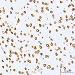 Lamin A/C Antibody in Immunohistochemistry (Paraffin) (IHC (P))