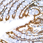 Lamin A/C Antibody in Immunohistochemistry (Paraffin) (IHC (P))