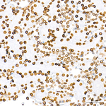 Lamin A/C Antibody in Immunohistochemistry (Paraffin) (IHC (P))