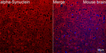 alpha Synuclein Antibody in Immunohistochemistry (Paraffin) (IHC (P))