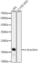 alpha Synuclein Antibody in Western Blot (WB)