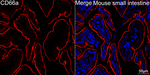 CD66a Recombinant Rabbit Monoclonal Antibody (3E5I1)