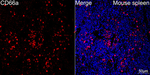 CD66a Antibody in Immunohistochemistry (Paraffin) (IHC (P))