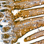 CD66a Antibody in Immunohistochemistry (Paraffin) (IHC (P))
