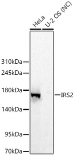 IRS2 Antibody in Western Blot (WB)