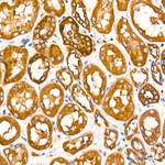 AMPK alpha-1,2 Antibody in Immunohistochemistry (Paraffin) (IHC (P))