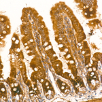 AMPK alpha-1,2 Antibody in Immunohistochemistry (Paraffin) (IHC (P))