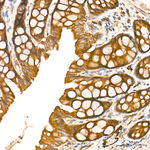 AMPK alpha-1,2 Antibody in Immunohistochemistry (Paraffin) (IHC (P))