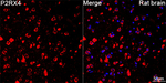 P2X4 Antibody in Immunohistochemistry (Paraffin) (IHC (P))