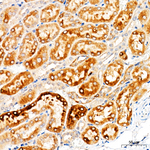 GLDC Antibody in Immunohistochemistry (Paraffin) (IHC (P))