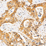 YAP1 Antibody in Immunohistochemistry (Paraffin) (IHC (P))