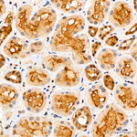 YAP1 Antibody in Immunohistochemistry (Paraffin) (IHC (P))