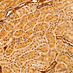 YAP1 Antibody in Immunohistochemistry (Paraffin) (IHC (P))