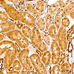 YAP1 Antibody in Immunohistochemistry (Paraffin) (IHC (P))