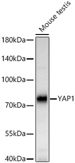 YAP1 Antibody in Western Blot (WB)