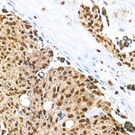 MiTF Antibody in Immunohistochemistry (Paraffin) (IHC (P))