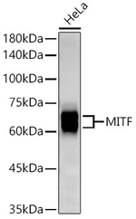 MiTF Antibody in Western Blot (WB)
